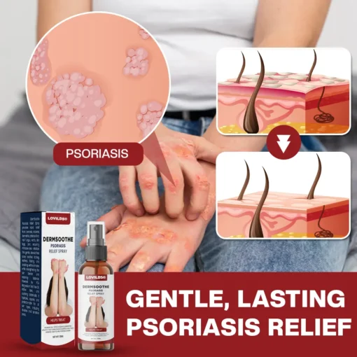 LOVILDS® DermSoothe Psoriasis Relief Spray