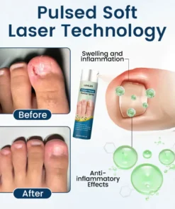 LOVILDS® Fungal Repair Herbal Spray