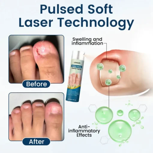 LOVILDS® Fungal Repair Herbal Spray