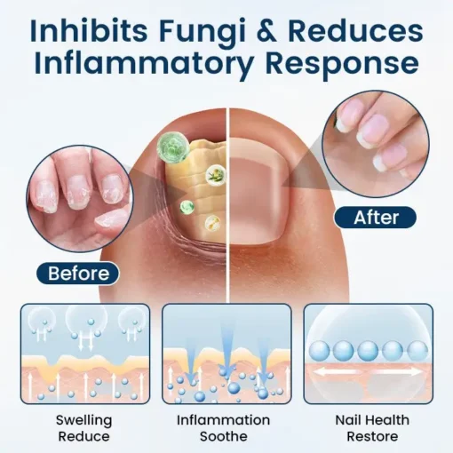 LOVILDS® Fungal Repair Herbal Spray