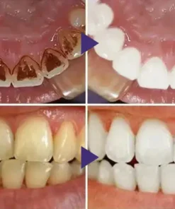 LOVILDS™ Gum Care Gel
