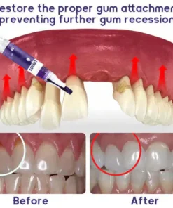 LOVILDS™ Gum Care Gel