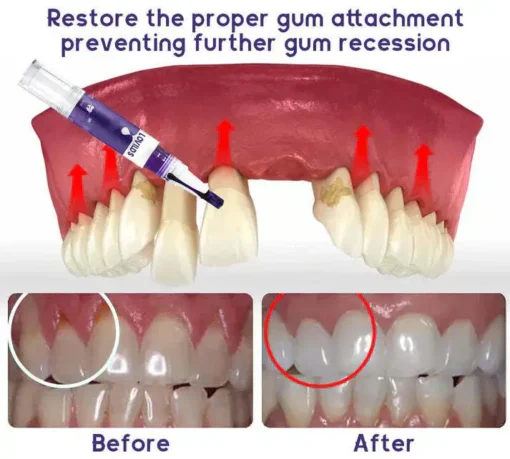 LOVILDS™ Gum Care Gel