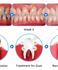 LOVILDS™ Gum Care Gel