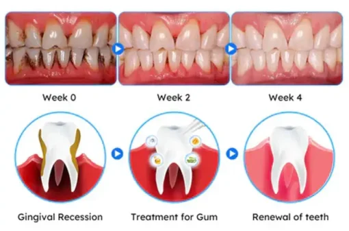 LOVILDS™ Gum Care Gel