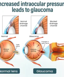 LOVILDS® OptiFusion Nano Eye Drops Serum