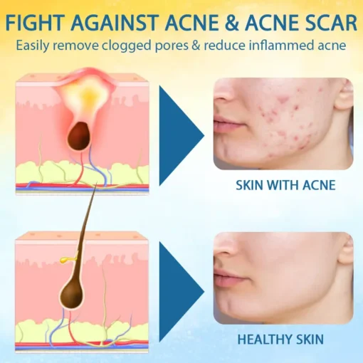 LOVILDS™ Psoriasis Care Mellifera Venom Skin Healing Spray