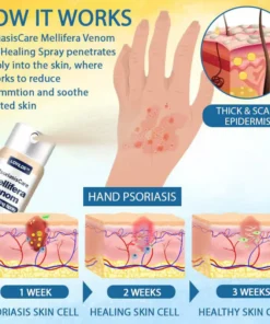 LOVILDS™ Psoriasis Care Mellifera Venom Skin Healing Spray