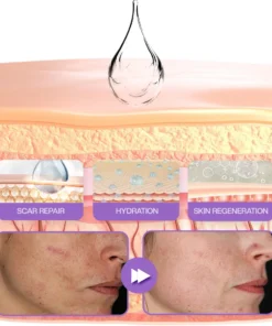 LOVILDS® RevivaDerma Face & Body Scar Gel