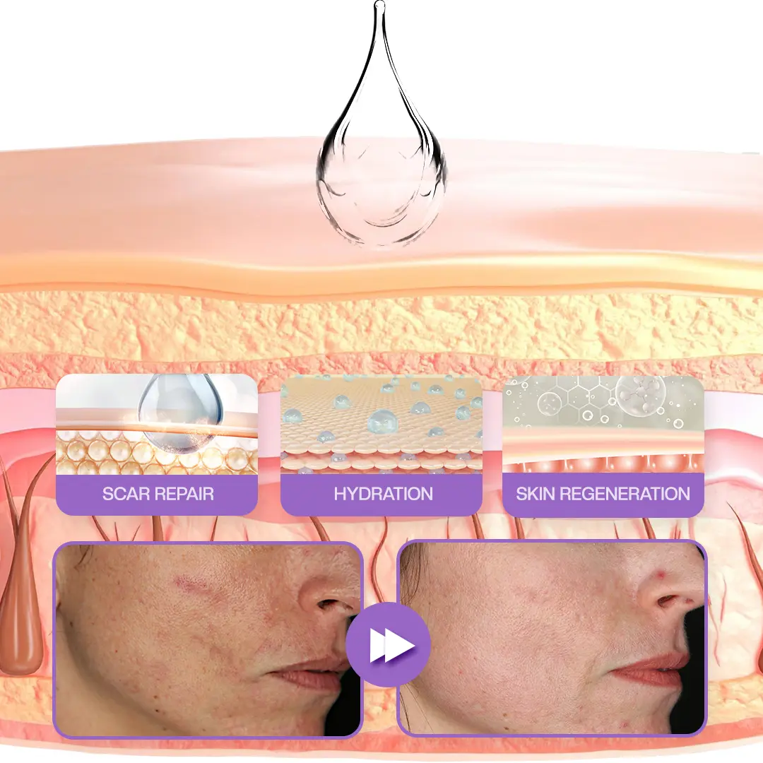 LOVILDS® RevivaDerma Face & Body Scar Gel