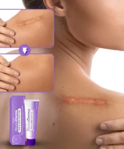 LOVILDS® RevivaDerma Face & Body Scar Gel
