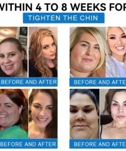 LOVILDS® SMGT-GLP-1 𝐓𝐢𝐫𝐳𝐞𝐩𝐚𝐭𝐢𝐝𝐞 & 𝐂𝐨𝐥𝐥𝐚𝐠𝐞𝐧 𝐍𝐚𝐧𝐨 𝐌𝐢𝐜𝐫𝐨𝐧𝐞𝐞𝐝𝐥𝐞 𝐖𝐞𝐢𝐠𝐡𝐭 𝐋𝐨𝐬𝐬 𝐏𝐚𝐭𝐜𝐡