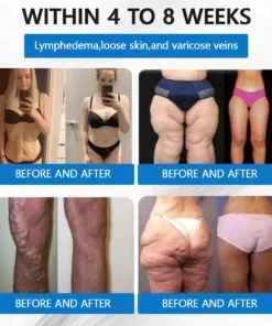 LOVILDS® SMGT-GLP-1 𝐓𝐢𝐫𝐳𝐞𝐩𝐚𝐭𝐢𝐝𝐞 & 𝐂𝐨𝐥𝐥𝐚𝐠𝐞𝐧 𝐍𝐚𝐧𝐨 𝐌𝐢𝐜𝐫𝐨𝐧𝐞𝐞𝐝𝐥𝐞 𝐖𝐞𝐢𝐠𝐡𝐭 𝐋𝐨𝐬𝐬 𝐏𝐚𝐭𝐜𝐡