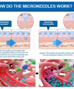 LOVILDS® SMGT-GLP-1 𝐓𝐢𝐫𝐳𝐞𝐩𝐚𝐭𝐢𝐝𝐞 & 𝐂𝐨𝐥𝐥𝐚𝐠𝐞𝐧 𝐍𝐚𝐧𝐨 𝐌𝐢𝐜𝐫𝐨𝐧𝐞𝐞𝐝𝐥𝐞 𝐖𝐞𝐢𝐠𝐡𝐭 𝐋𝐨𝐬𝐬 𝐏𝐚𝐭𝐜𝐡