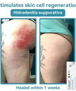 LOVILDS® SonicLift Pro