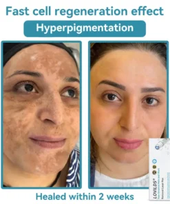 LOVILDS® SonicLift Pro