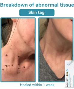 LOVILDS® SonicLift Pro