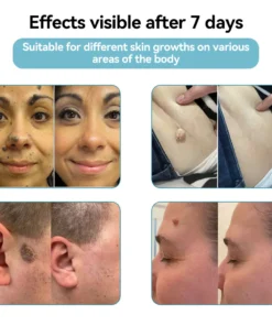 LOVILDS® SonicLift Pro