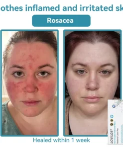 LOVILDS® SonicLift Pro