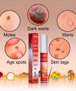 LOVILDS™ Tags & Moles Remover
