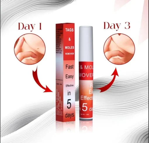 LOVILDS™ Tags & Moles Remover