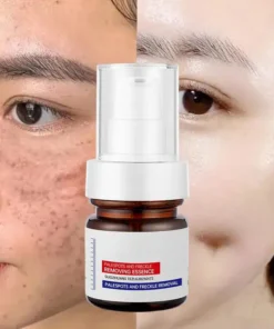 LOVILDS™ WHITENING ANDFRECKLE REMOVING ESSENCE