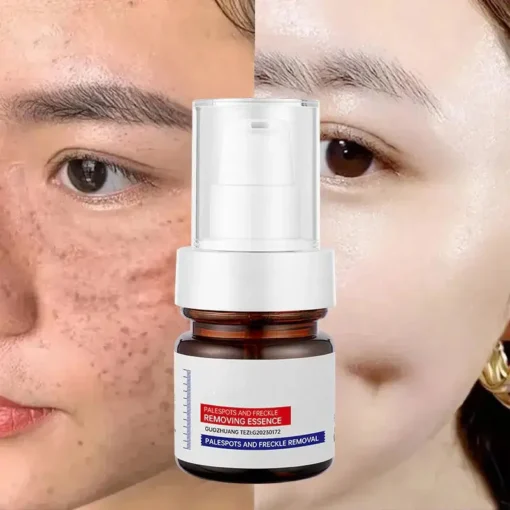 LOVILDS™ WHITENING ANDFRECKLE REMOVING ESSENCE
