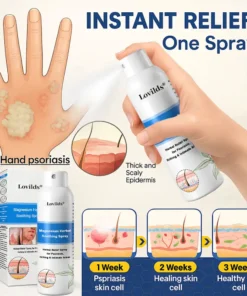 Lovilds® Magnesium Herbal Psoriasis Spray