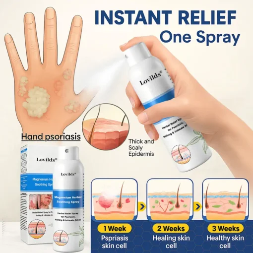 Lovilds® Magnesium Herbal Psoriasis Spray