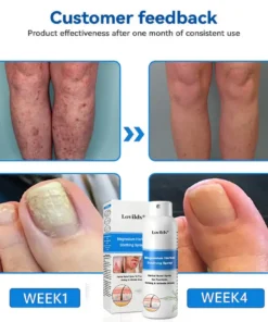 Lovilds® Magnesium Herbal Psoriasis Spray