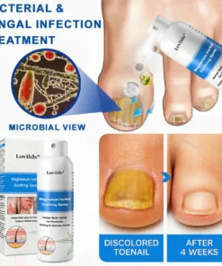 Lovilds® Magnesium Herbal Psoriasis Spray