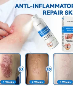 Lovilds® Magnesium Herbal Psoriasis Spray