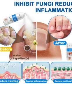 Lovilds® Magnesium Herbal Psoriasis Spray
