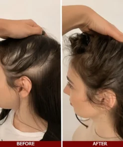 LOVILDS™ Advanced Hair Growth Serum