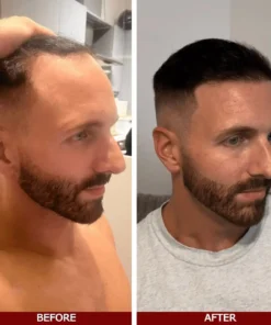 LOVILDS™ Advanced Hair Growth Serum