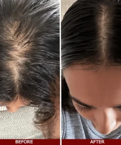 LOVILDS™ Advanced Hair Growth Serum