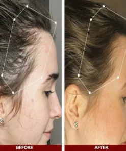 LOVILDS™ Advanced Hair Growth Serum