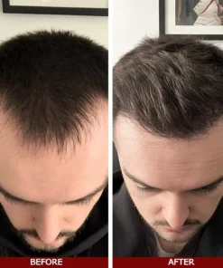 LOVILDS™ Advanced Hair Growth Serum