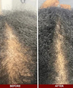 LOVILDS™ Advanced Hair Growth Serum