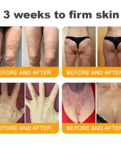 LOVILDS™ Bee Venom Skin Restoration Cream