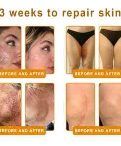 LOVILDS™ Bee Venom Skin Restoration Cream