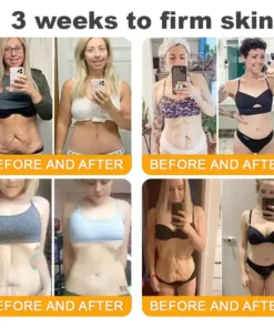 LOVILDS™ Bee Venom Skin Restoration Cream