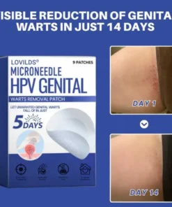 LOVILDS® Microneedle Patch — Effective for All Types of HPV Warts
