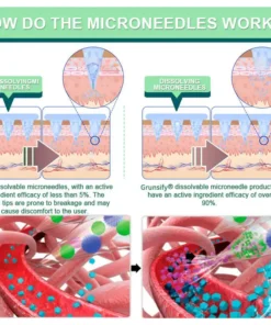 LOVILDS® NIDDK-Tirzepatide Nano Patch