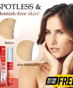 LOVILDS™ Warts & Tags Remover