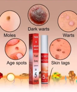 LOVILDS™ Warts & Tags Remover