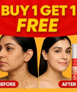 LOVILDS™ Warts & Tags Remover