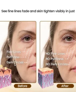 LOVILDS™Skin Firming and Wrinkle Reducing Essence