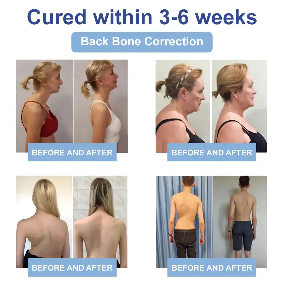 LOVILDS® Black Rice Pain Healing Bone Cream