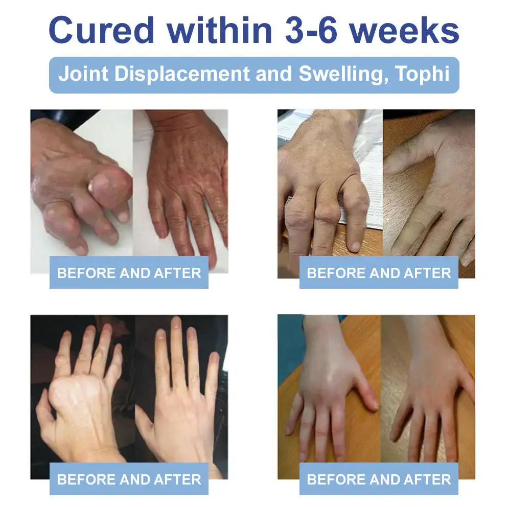 LOVILDS® Black Rice Pain Healing Bone Cream